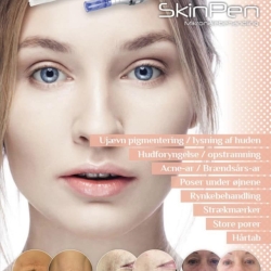 SkinPen microneedling poster