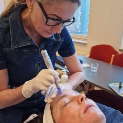 SkinPen microneedling behandling ved Fiiint - Skønhed i Mårslet når Aarhus og Odder