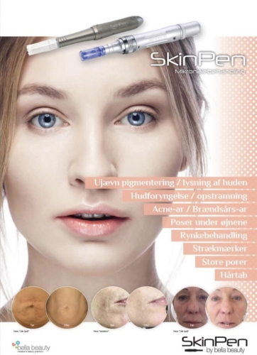 SkinPen microneedling poster