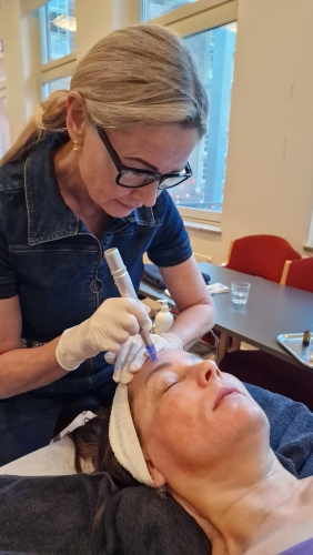 SkinPen microneedling behandling ved Fiiint - Skønhed i Mårslet når Aarhus og Odder